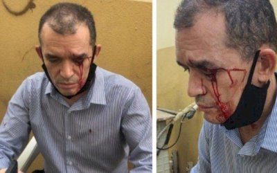Ex-pastores invadem templos da Igreja Universal em Angola
