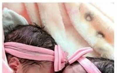 Recém-nascidas gêmeas morrem após serem atacadas por cachorro da família