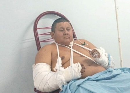 “É um presente de aniversário estar aqui”, diz trabalhador que sofreu ataque de onça.