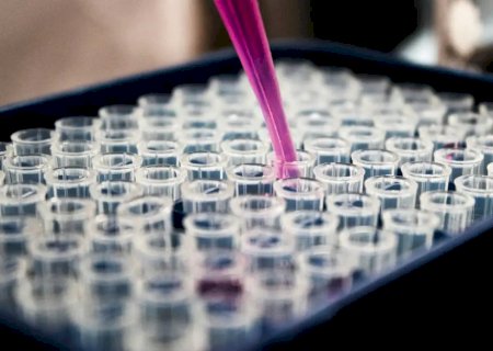 Pesquisas brasileiras avançam no diagnóstico de Alzheimer