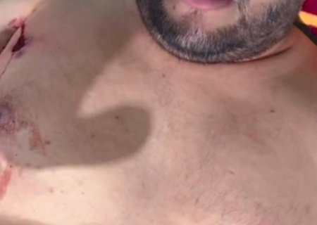 Proprietário de conveniência sofre tentativa de homicídio